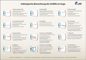 Lehrtafel - Iridologische Betrachtung der Gefäße im Auge